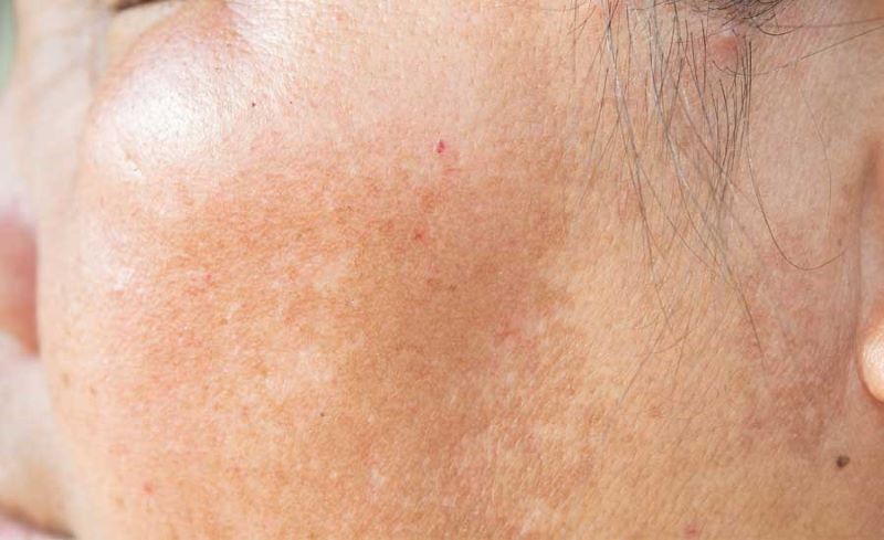 duy trì dưỡng ẩm và bổ sung dưỡng chất là thao tác thiết yếu để giữ cho da khỏe mạnh và cải thiện sắc tố một cách tự nhiên.