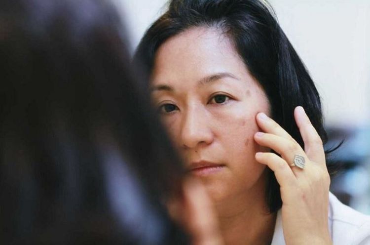 với tình trạng nám da do ánh nắng mặt trời gây ra, việc giữ gìn và bảo vệ làn da ngay cả khi không có dấu hiệu nám rõ ràng là rất cần thiết