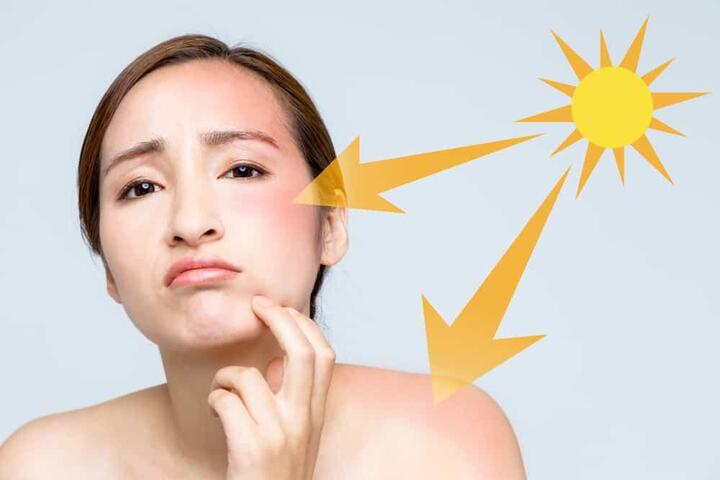 hiểu rõ nguyên nhân gây nám da đóng vai trò then chốt trong việc lựa chọn phương pháp chăm sóc và điều trị phù hợp.